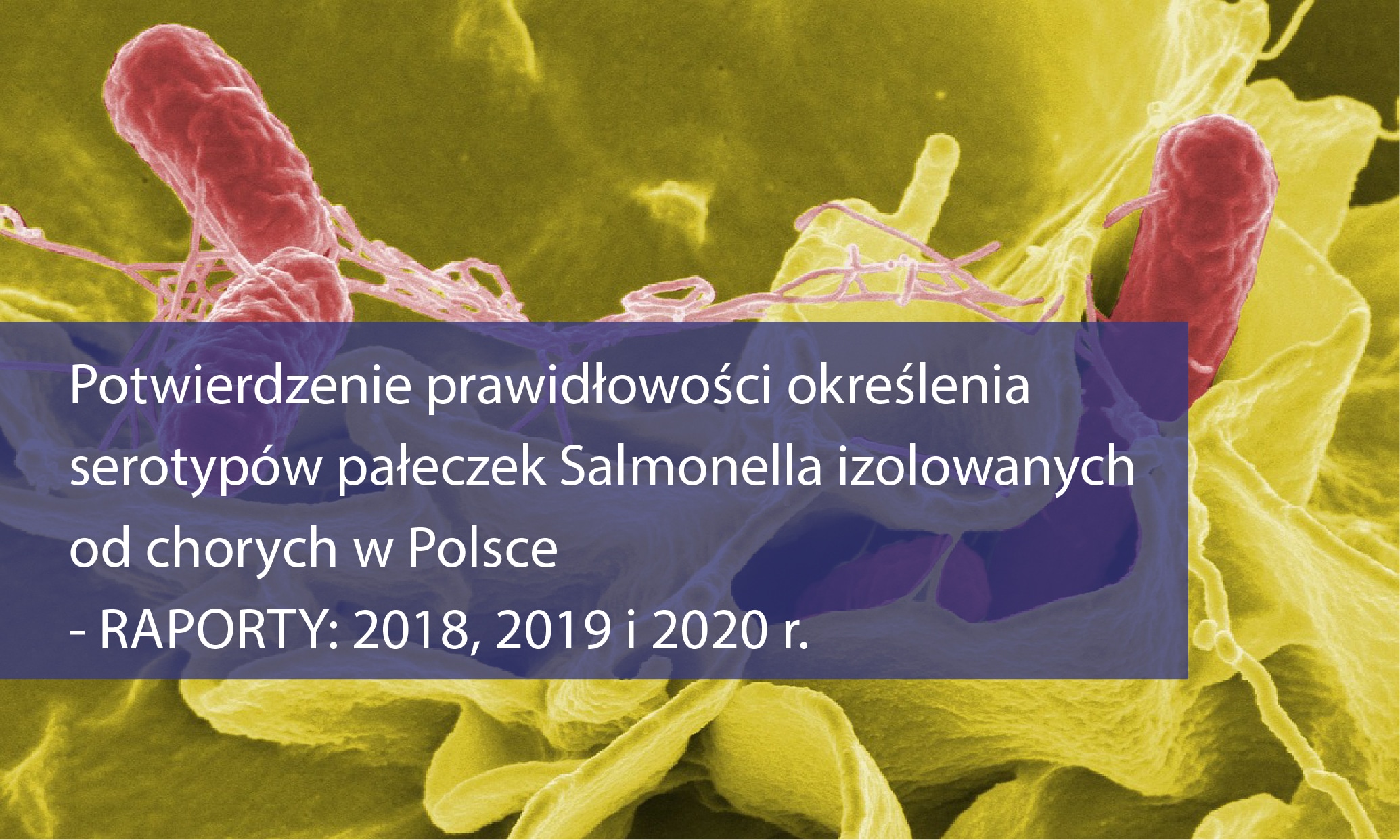 Read more about the article Potwierdzenie prawidłowości określenia serotypów pałeczek Salmonella izolowanych od chorych w Polsce – RAPORTY 2018, 2019 i 2020 rok